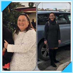 Chiara McCool before and after bariatric surgery