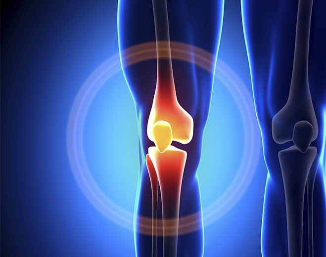 orthopedics-knee-joint-pain-relief-replacement